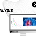 Survival Analysis of Patients with Lung Cancer
